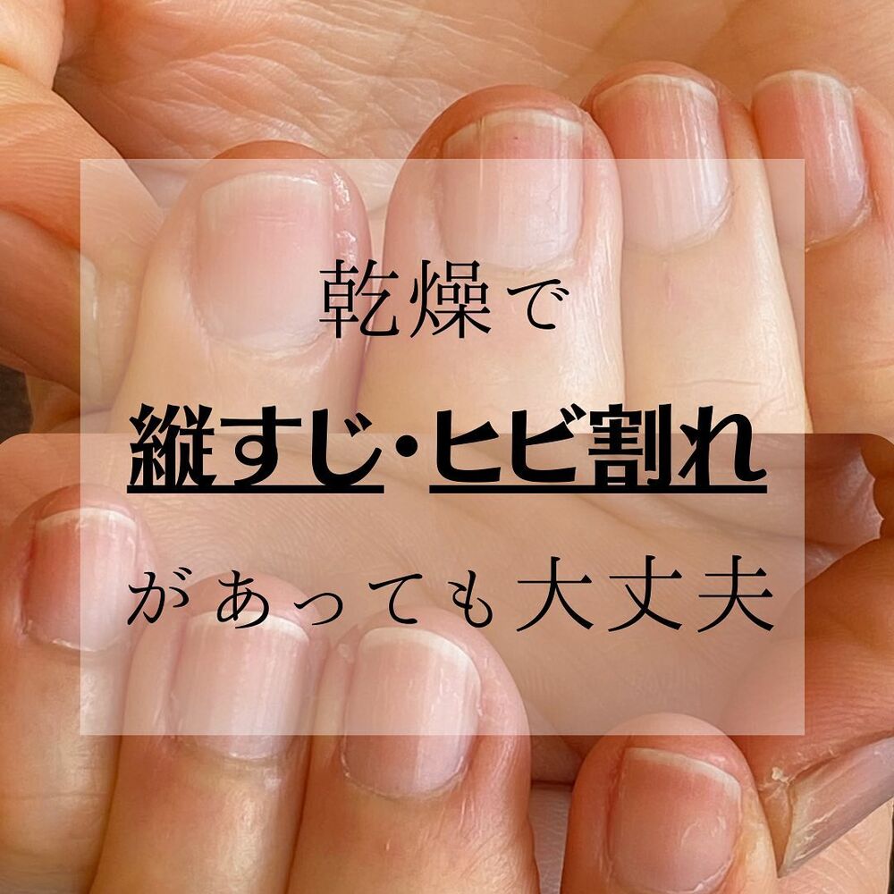 画像1322