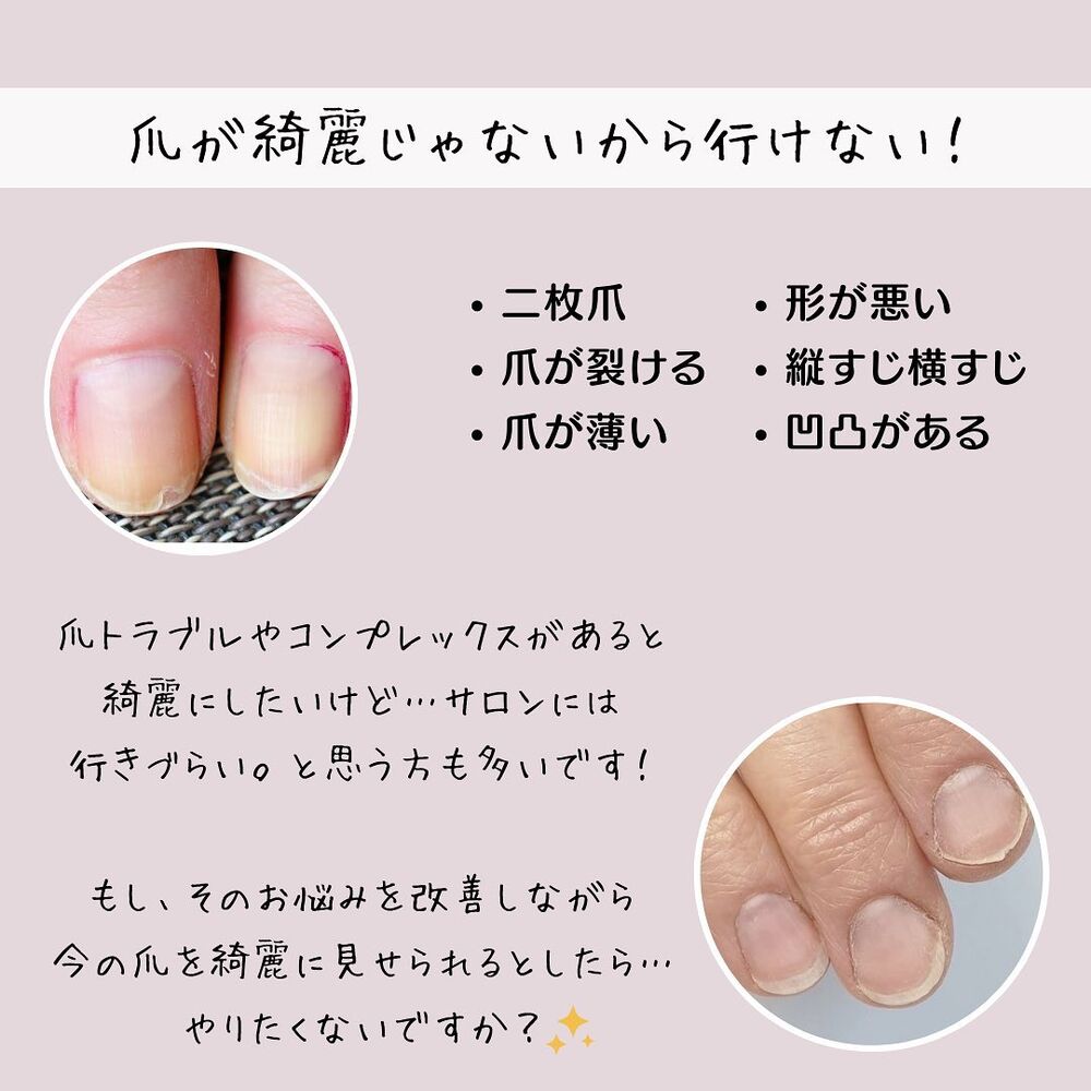 画像1327